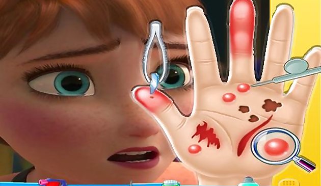 Anna Frozen Hand Doctor: Jeux amusants pour les filles Onlin